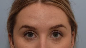 Key concepts in facial anatomy for brow shaping